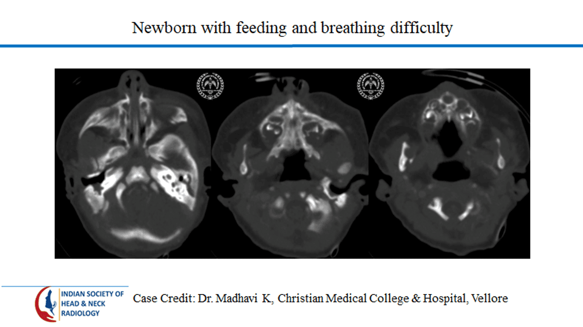 Case 4 — slide 1 of 3