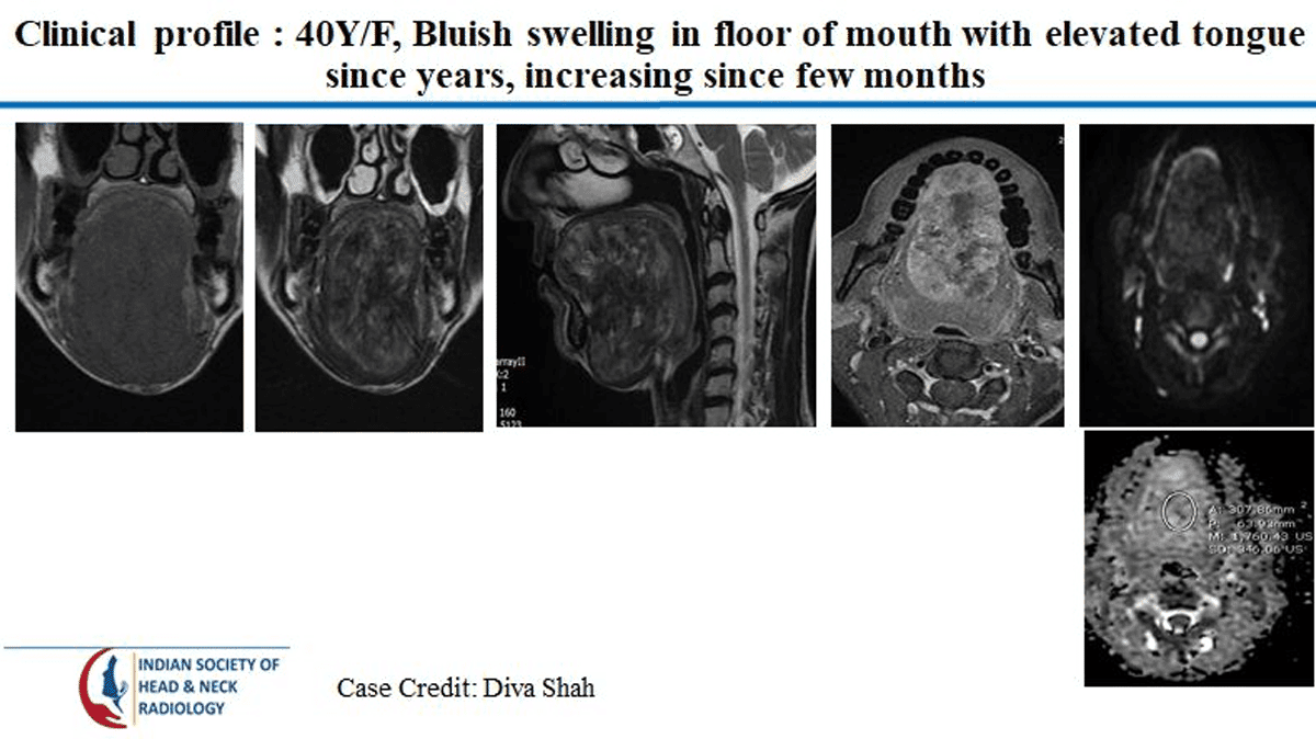 Case 5 — slide 1 of 2