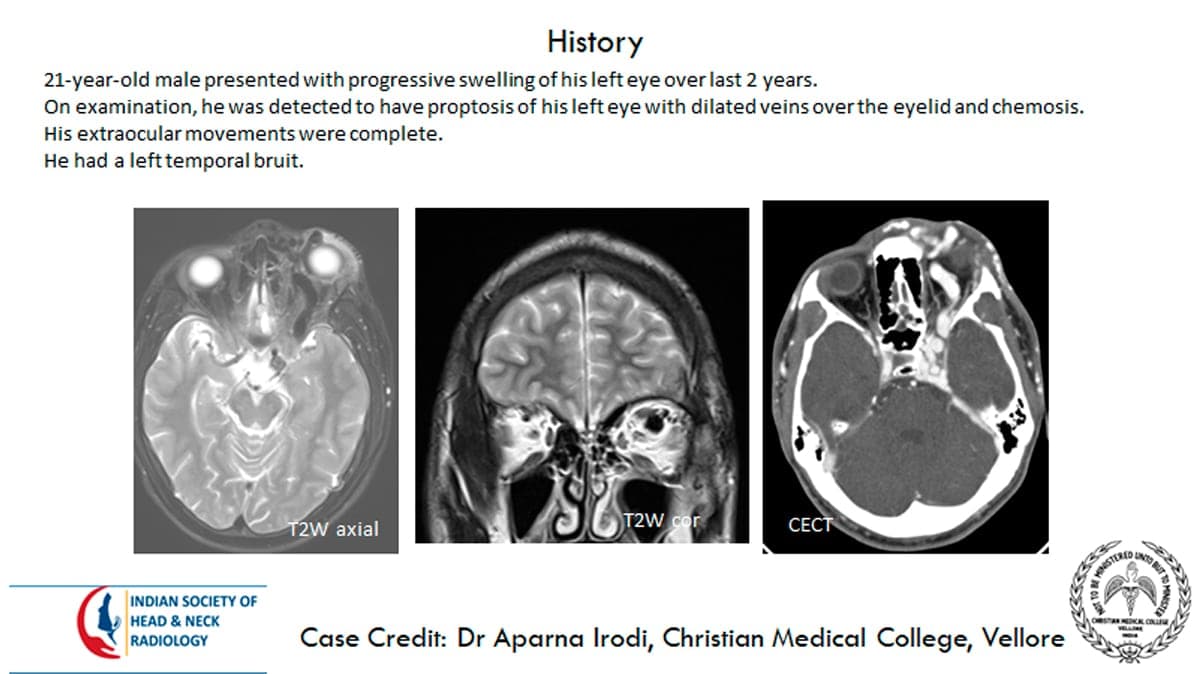 Case 7 — slide 1 of 3