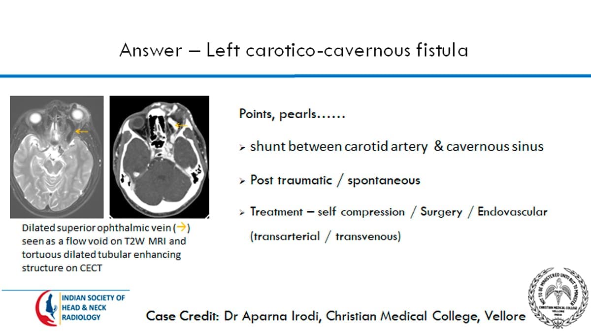 Case 7 thumbnail 2