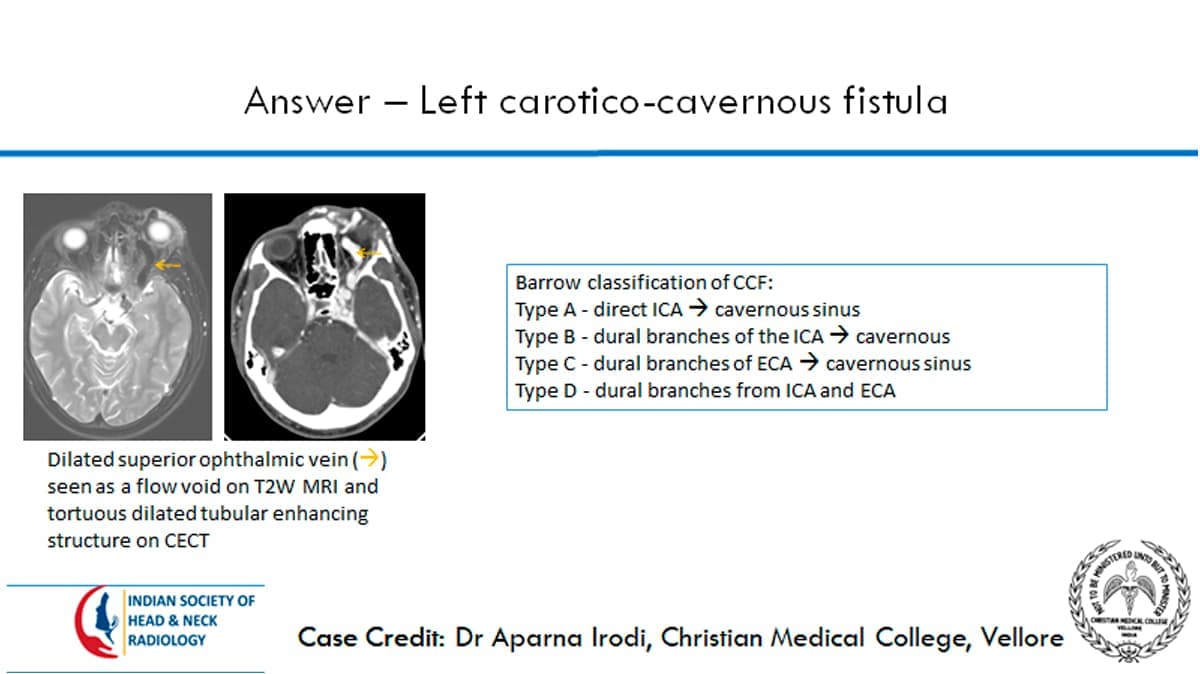 Case 7 thumbnail 3