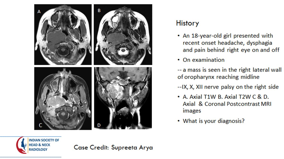 Case 10 — slide 1 of 4