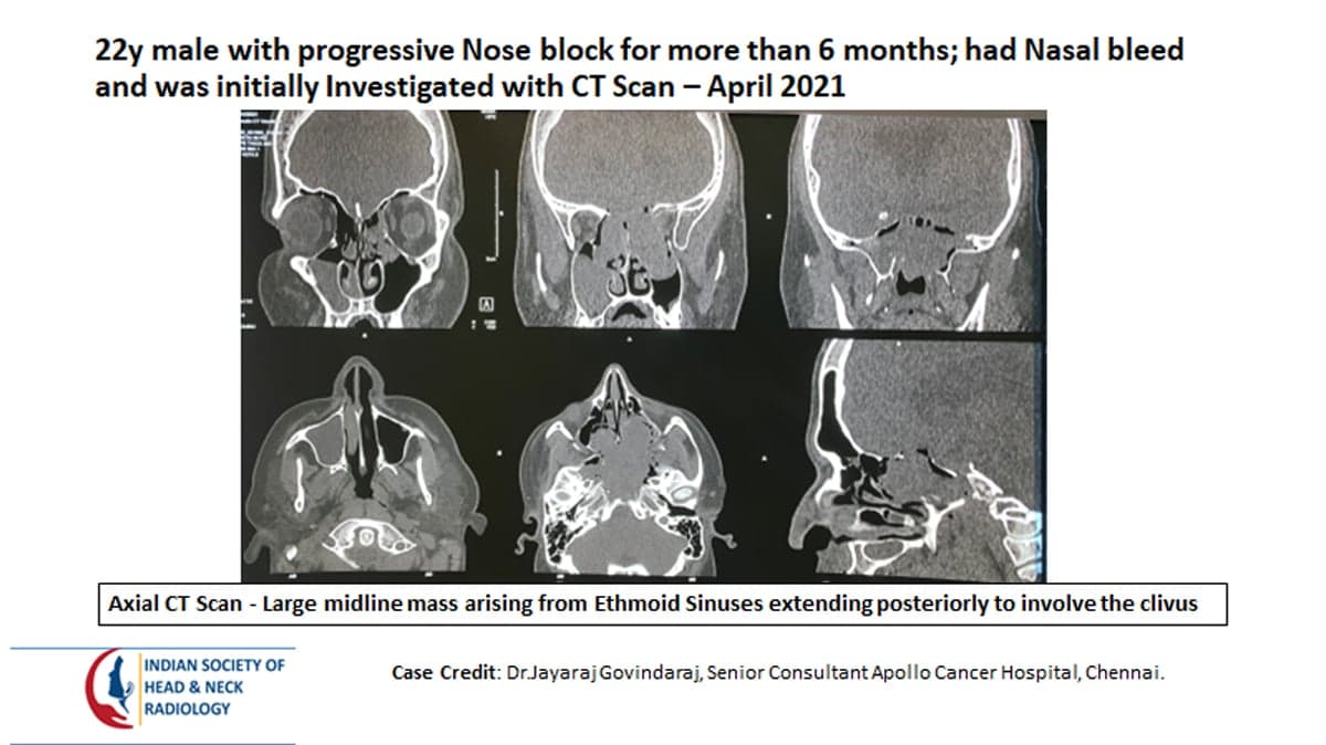 Case 13 — slide 1 of 4