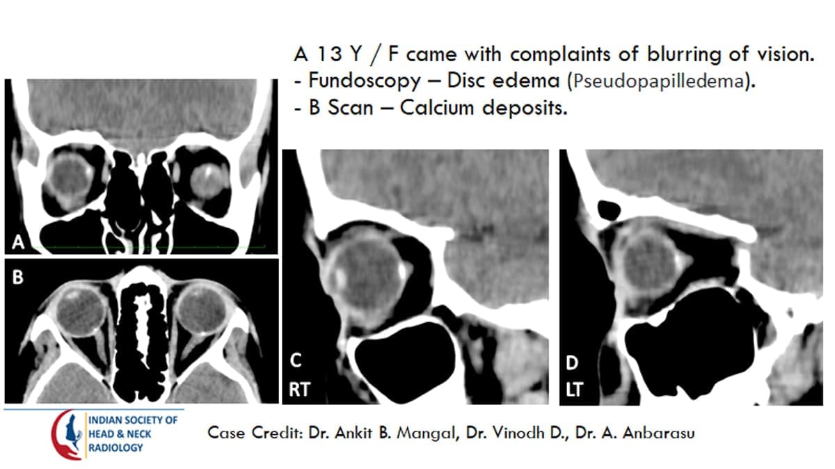 Case 14 — slide 1 of 3