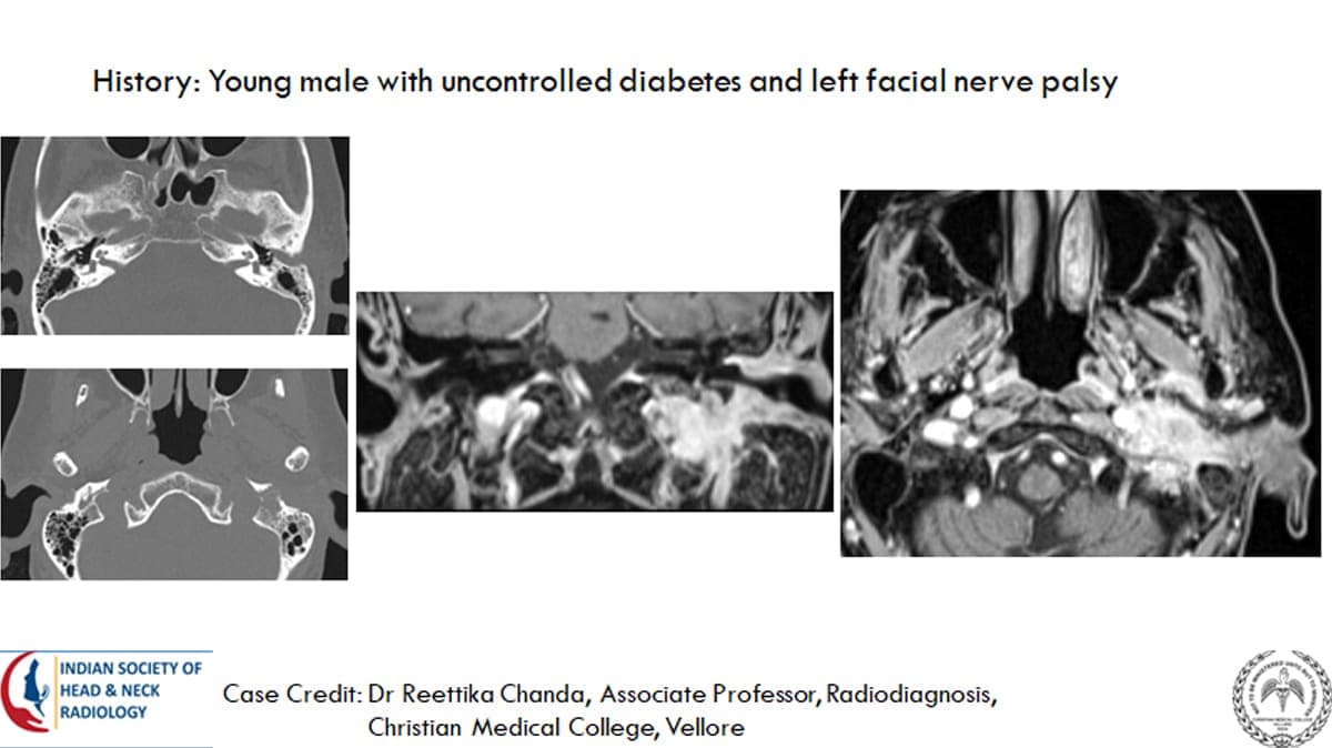 Case 15 — slide 1 of 2