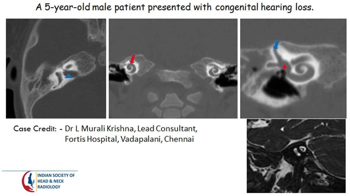 Case 17 — slide 1 of 4