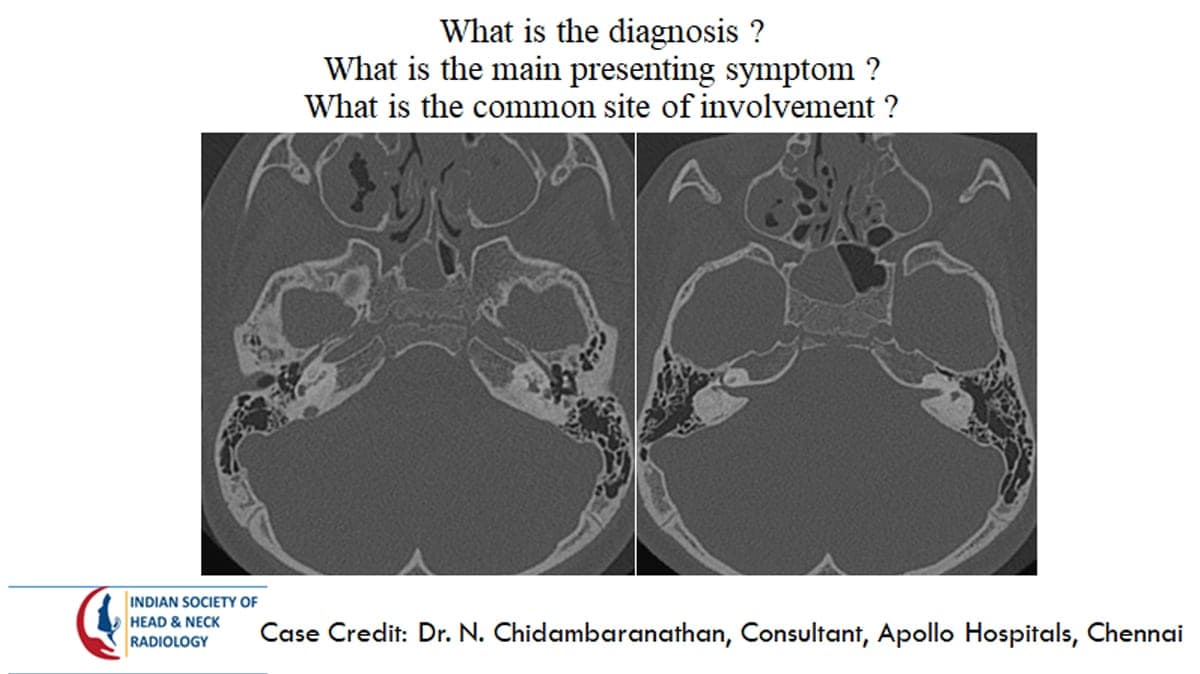 Case 18 — slide 1 of 2