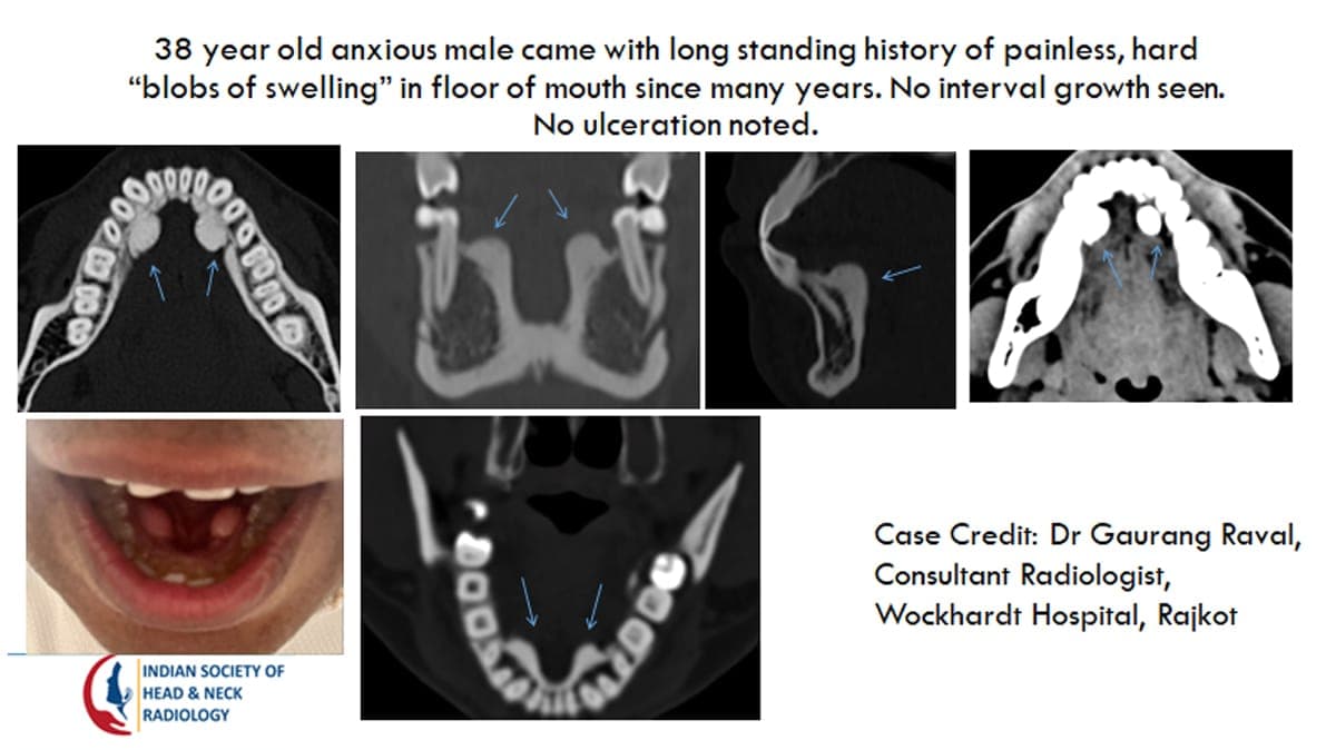 Case 19 — slide 1 of 3