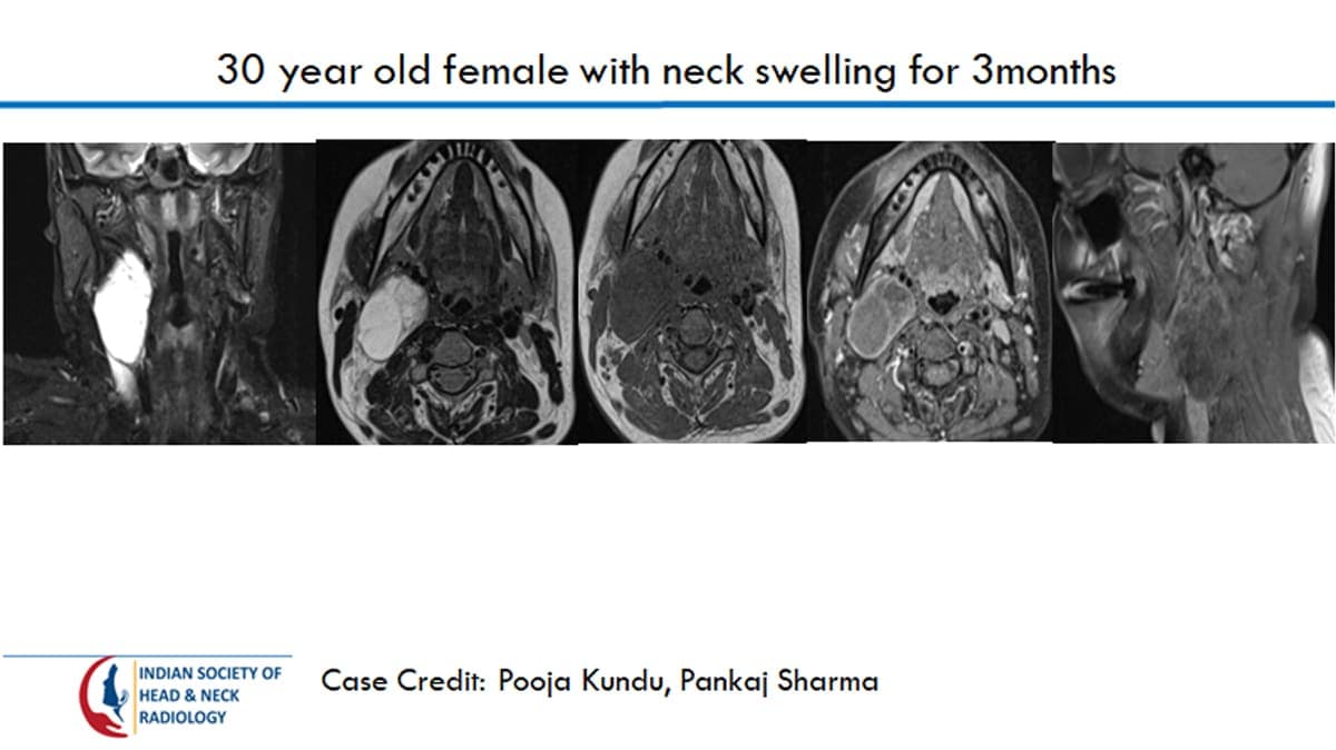 Case 21 — slide 1 of 3