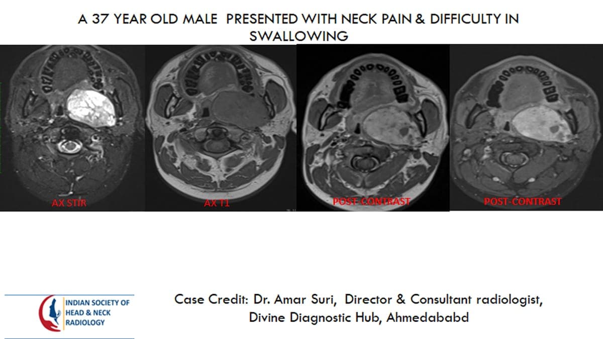 Case 22 — slide 1 of 5