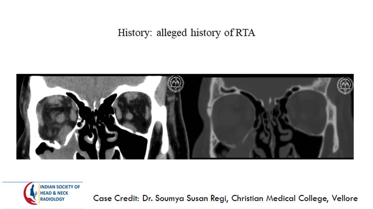 Case 23 — slide 1 of 3