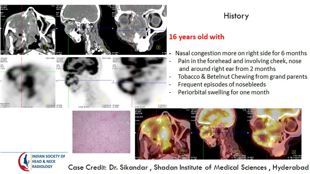 Case 25 — slide 1 of 4