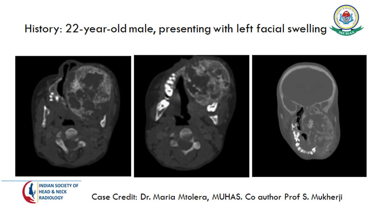 Case 26 — slide 1 of 3