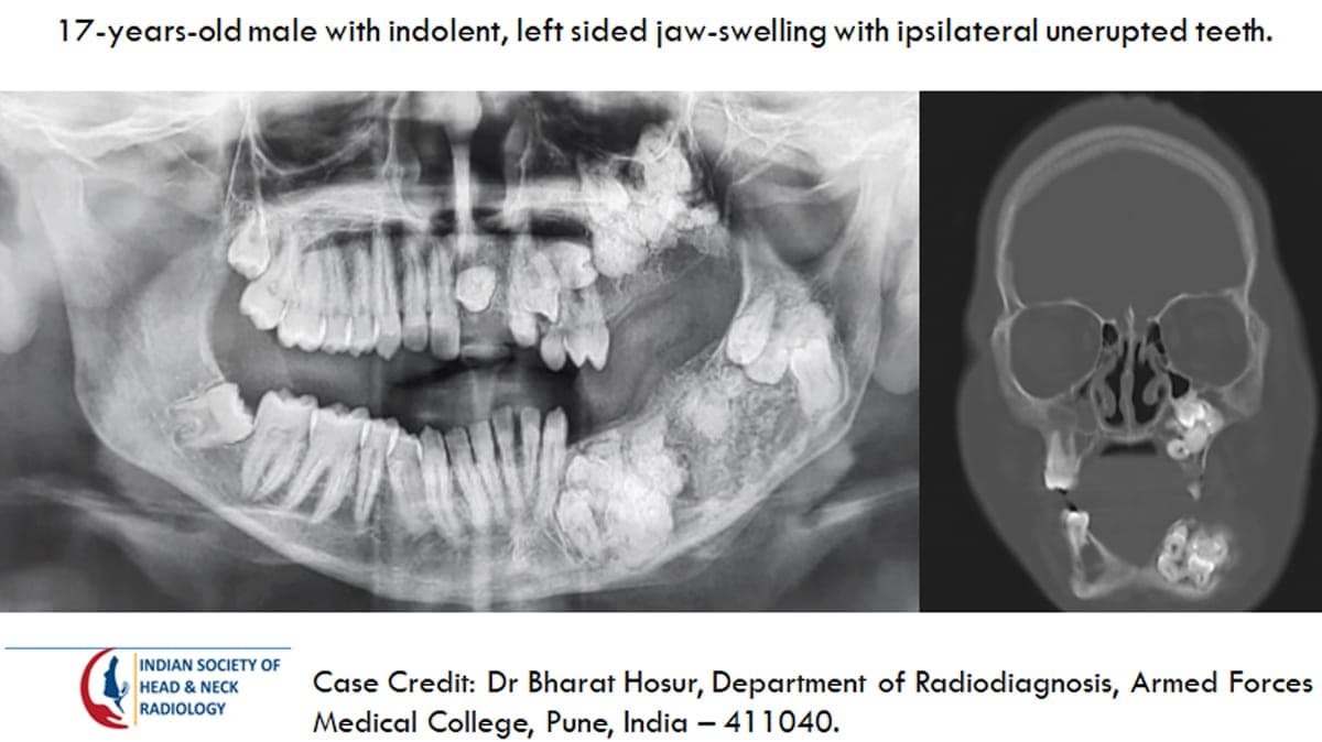 Case 28 — slide 1 of 4