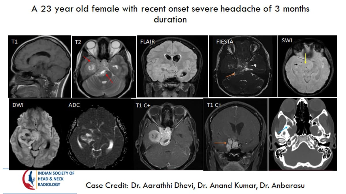 Case 29 — slide 1 of 3