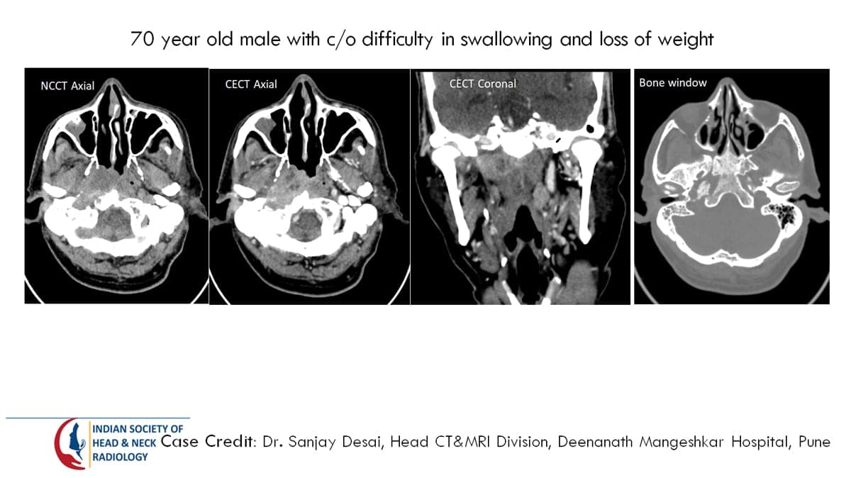 Case 30 — slide 1 of 6