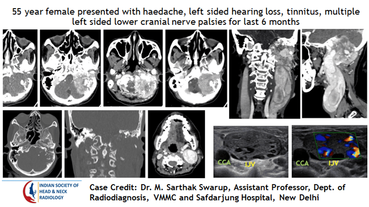 Case 31 — slide 1 of 3