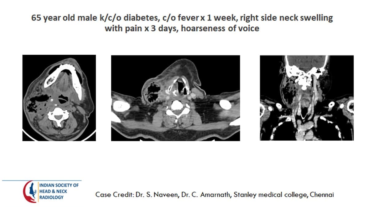 Case 33 — slide 1 of 3