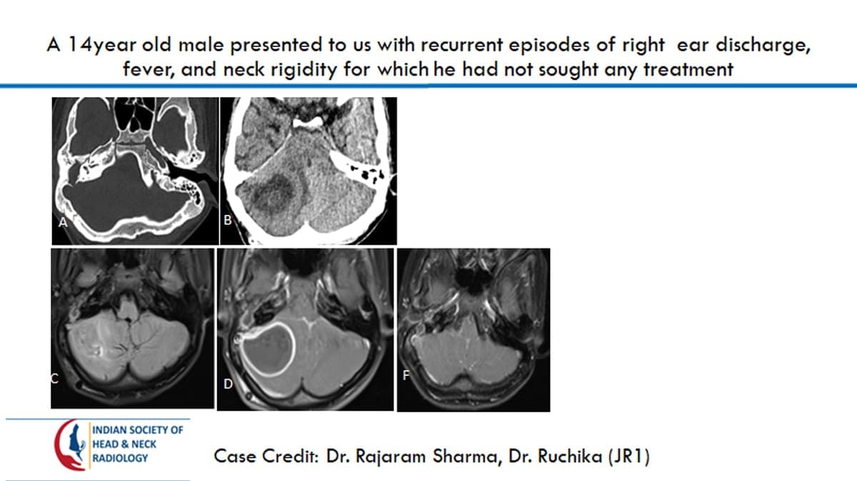 Case 34 — slide 1 of 3