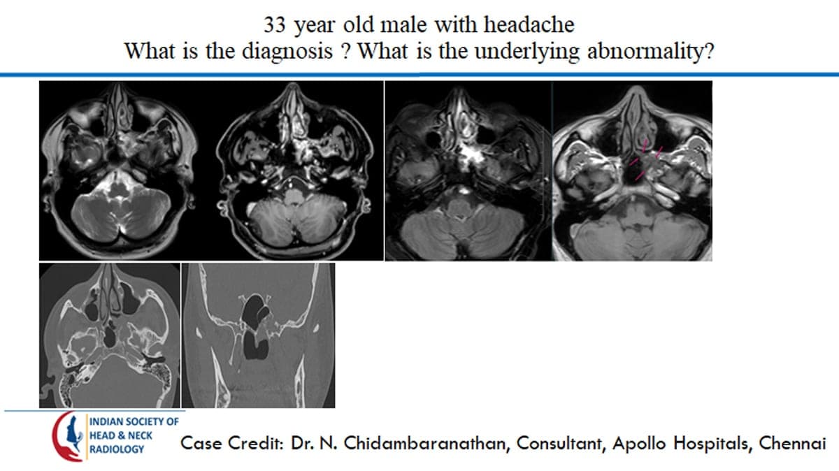 Case 35 — slide 1 of 3