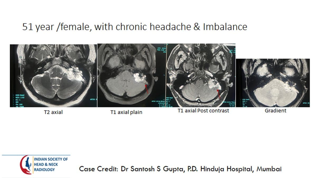 Case 38 — slide 1 of 3