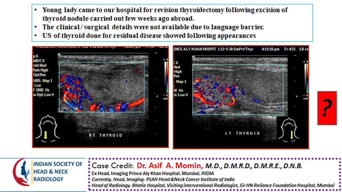 Case 39 — slide 1 of 3