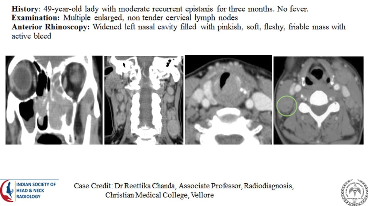 Case 41 — slide 1 of 4