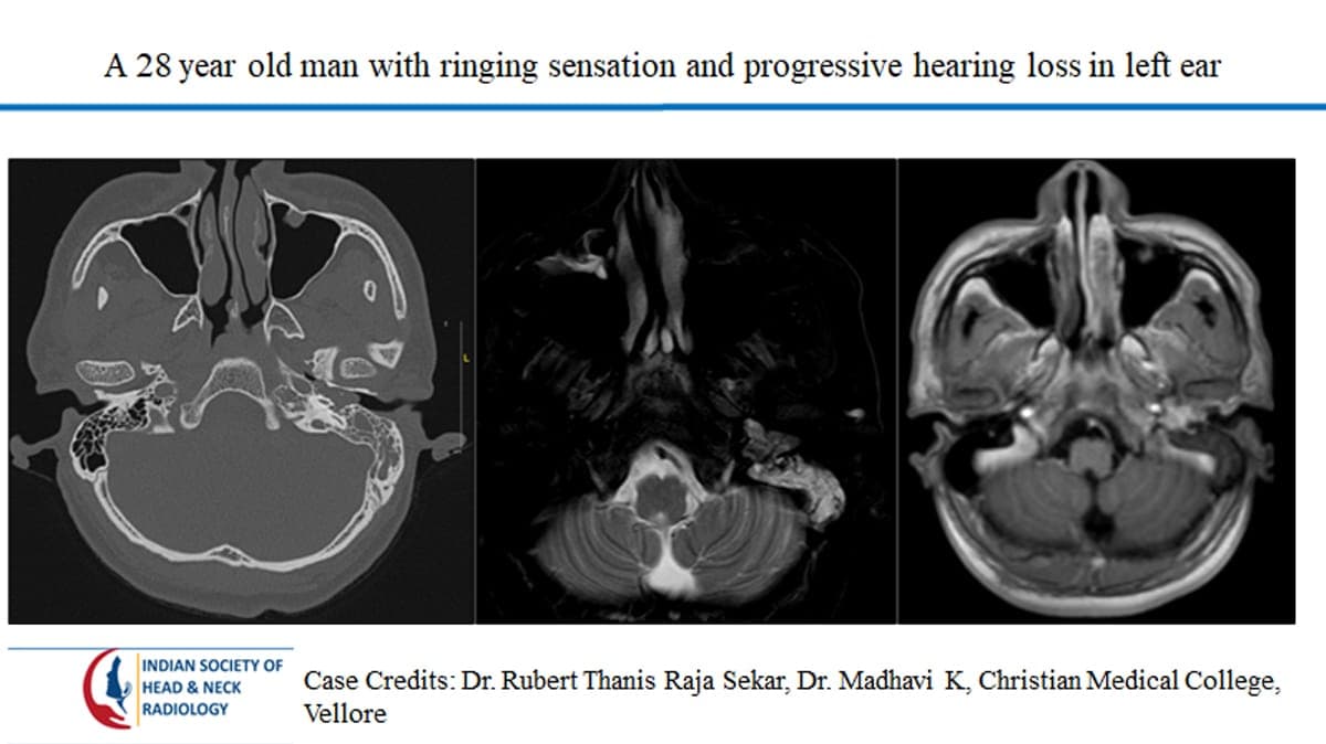 Case 42 — slide 1 of 3