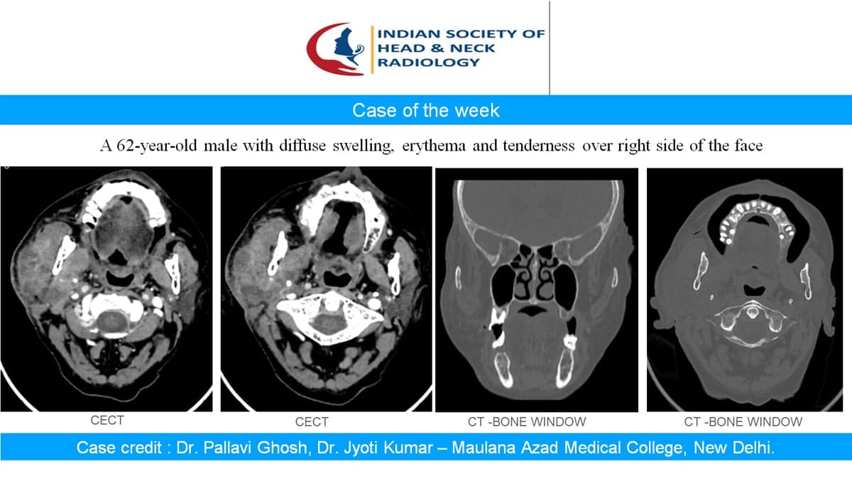 Case 43 — slide 1 of 4