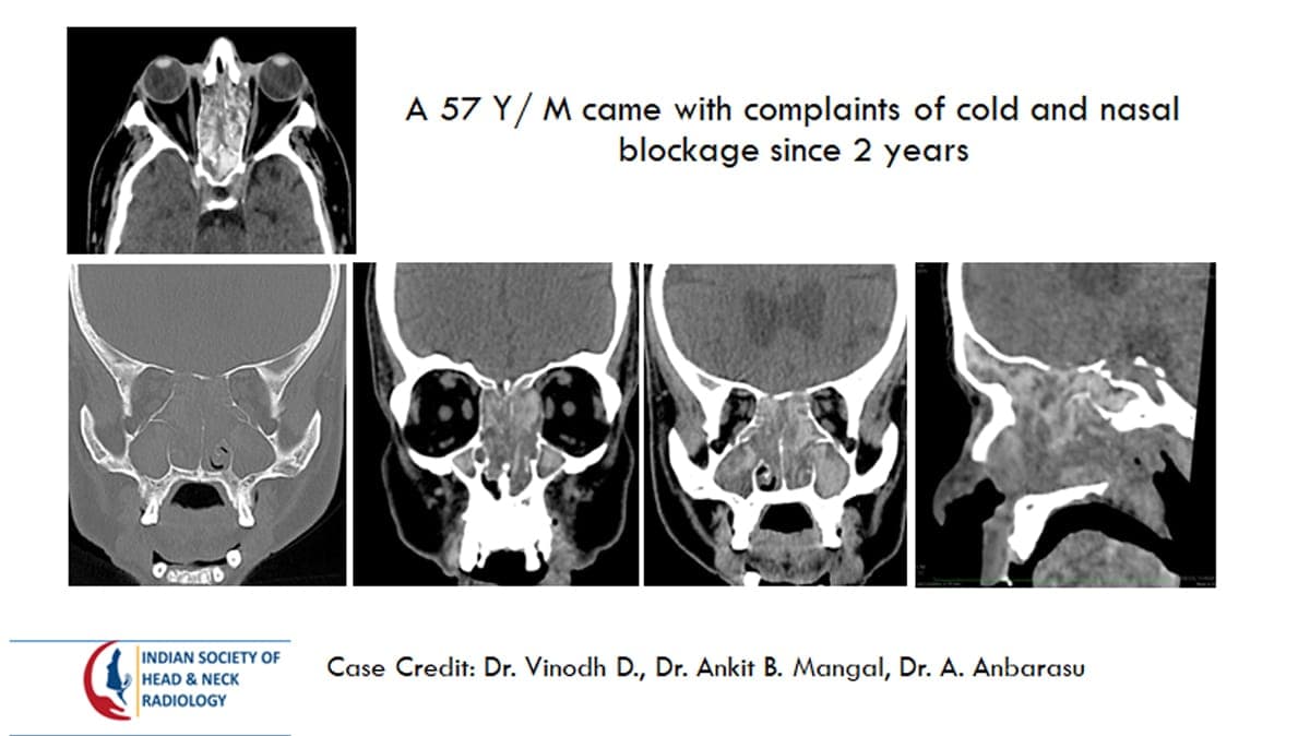 Case 44 — slide 1 of 4