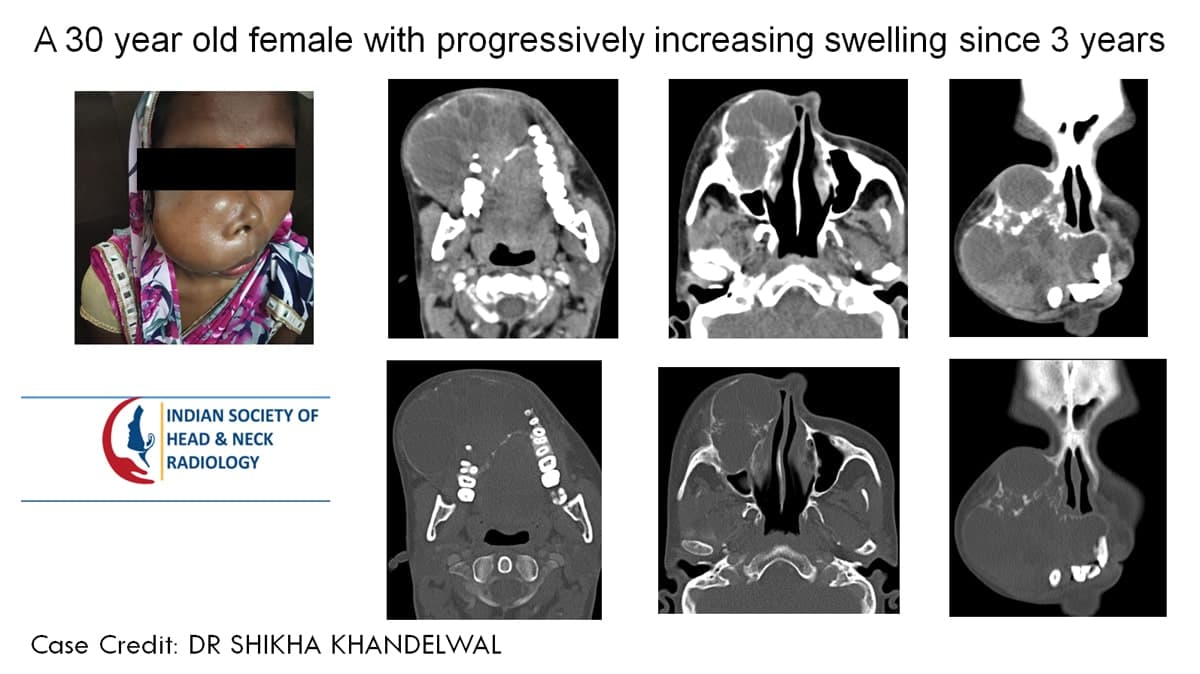 Case 46 — slide 1 of 2