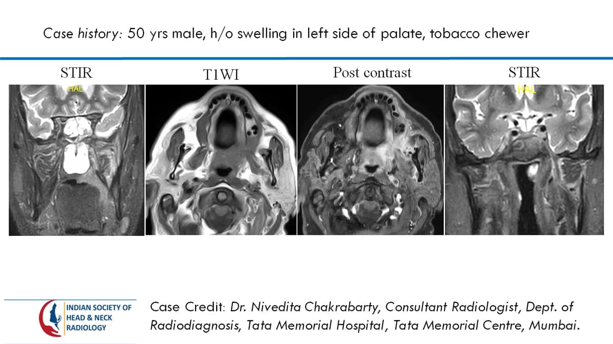Case 49 — slide 1 of 3