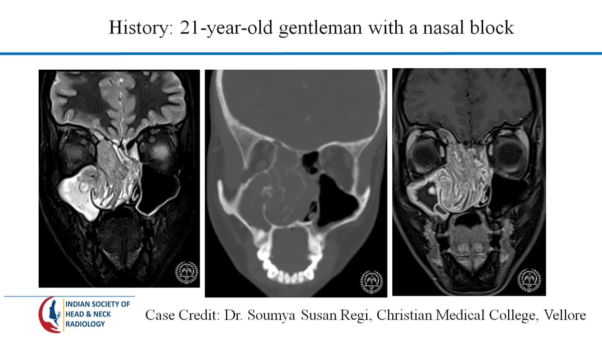 Case 51 — slide 1 of 4