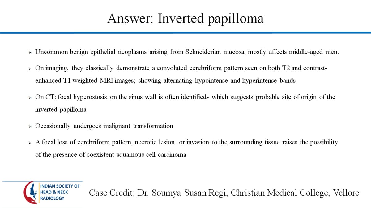 Case 51 thumbnail 3