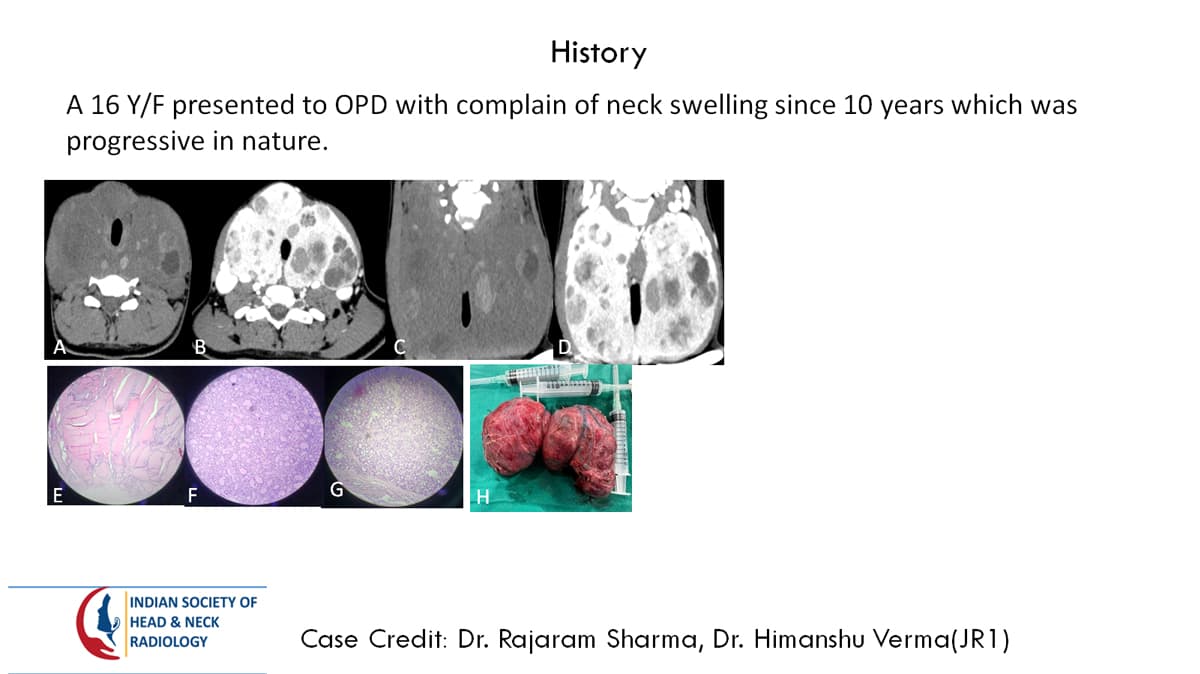 Case 52 — slide 1 of 3