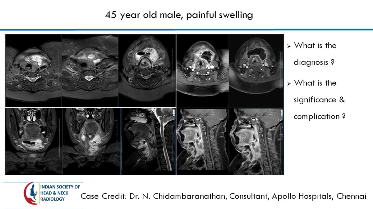 Case 53 — slide 1 of 2