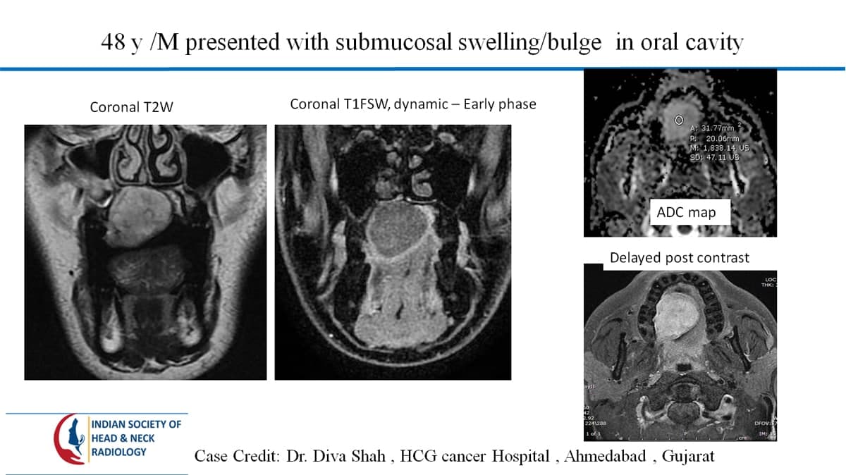 Case 54 — slide 1 of 3