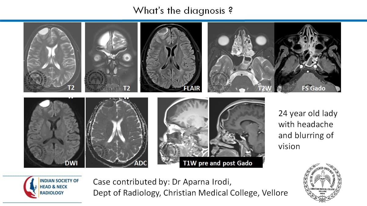 Case 55 — slide 1 of 2