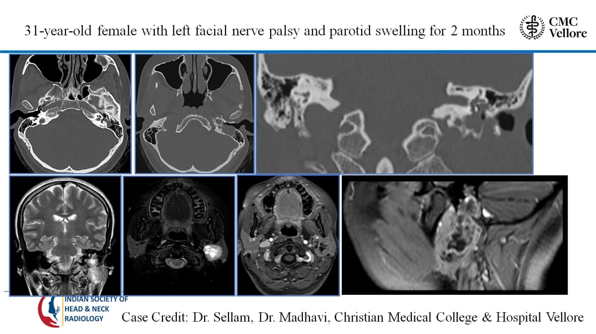 Case 58 — slide 1 of 2