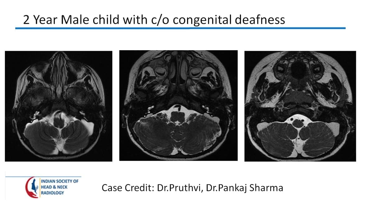 Case 60 — slide 1 of 4