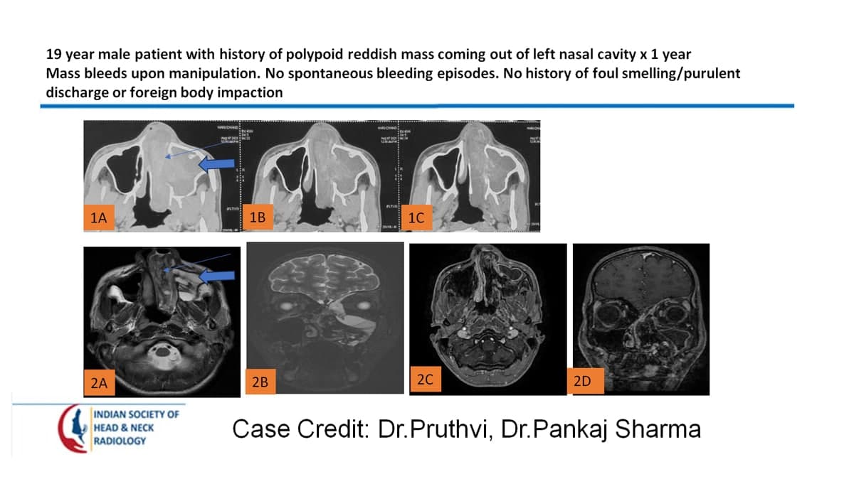 Case 61 — slide 1 of 4