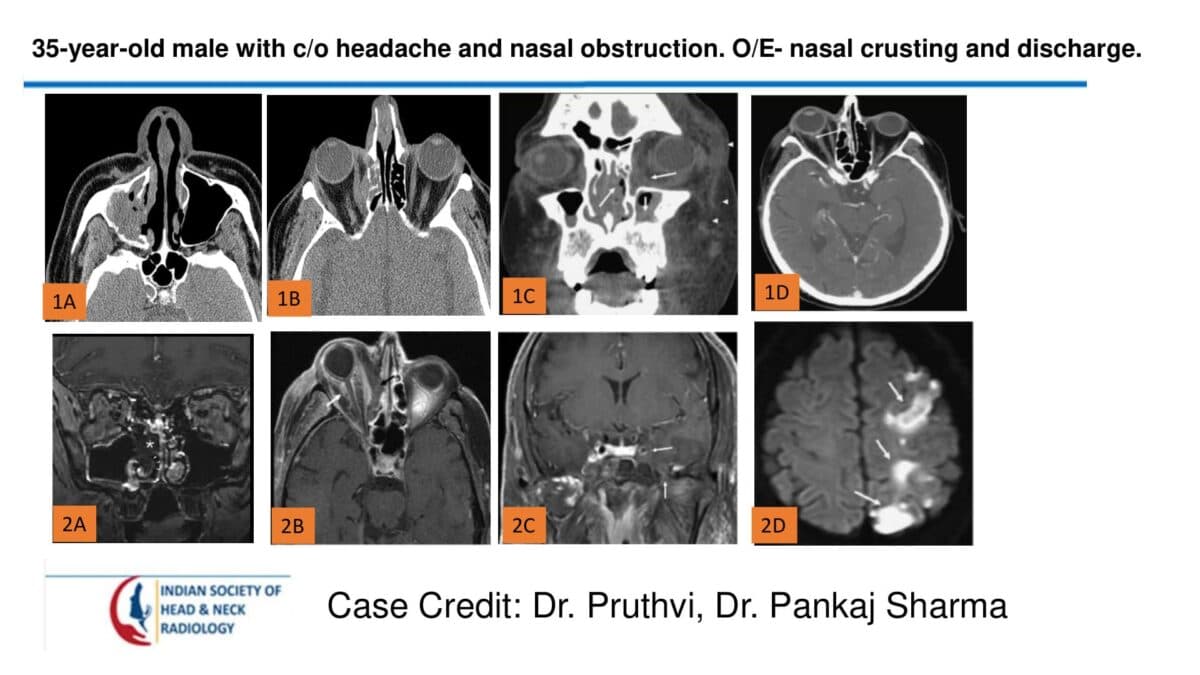 Case 63 — slide 1 of 3