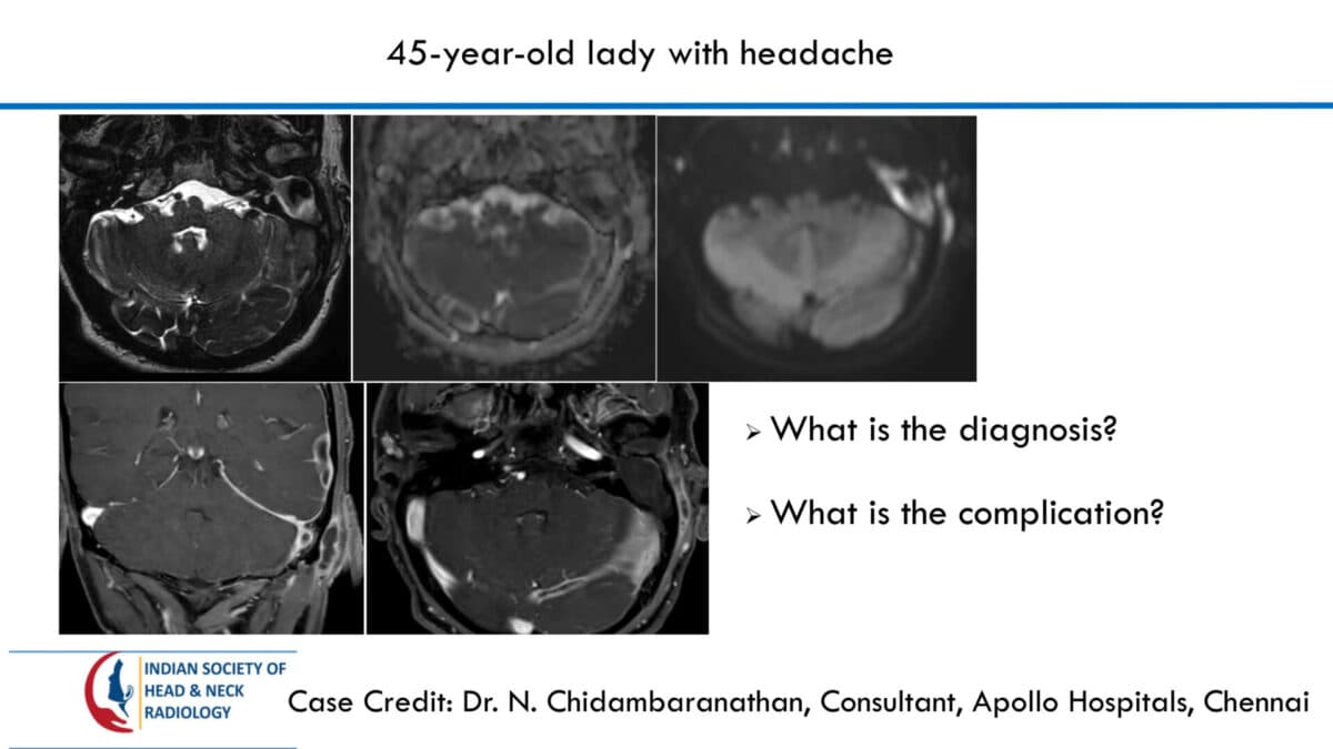 Case 65 — slide 1 of 2