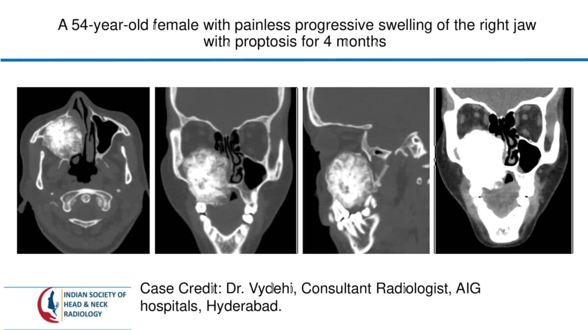 Case 67 — slide 1 of 4