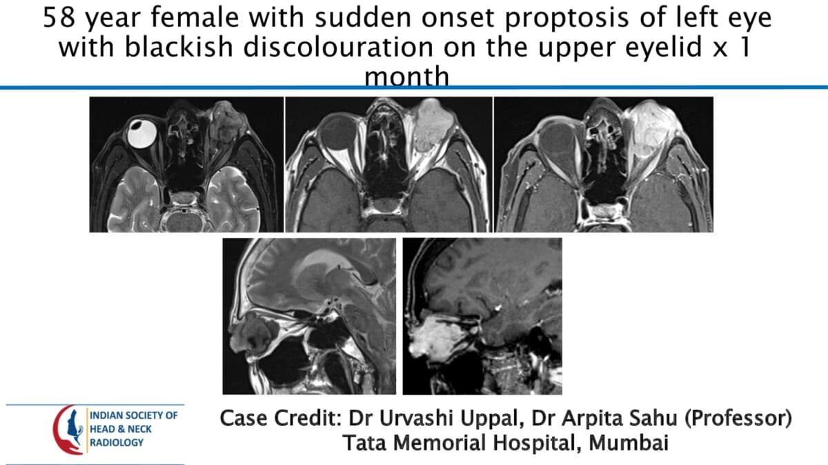 Case 71 — slide 1 of 4