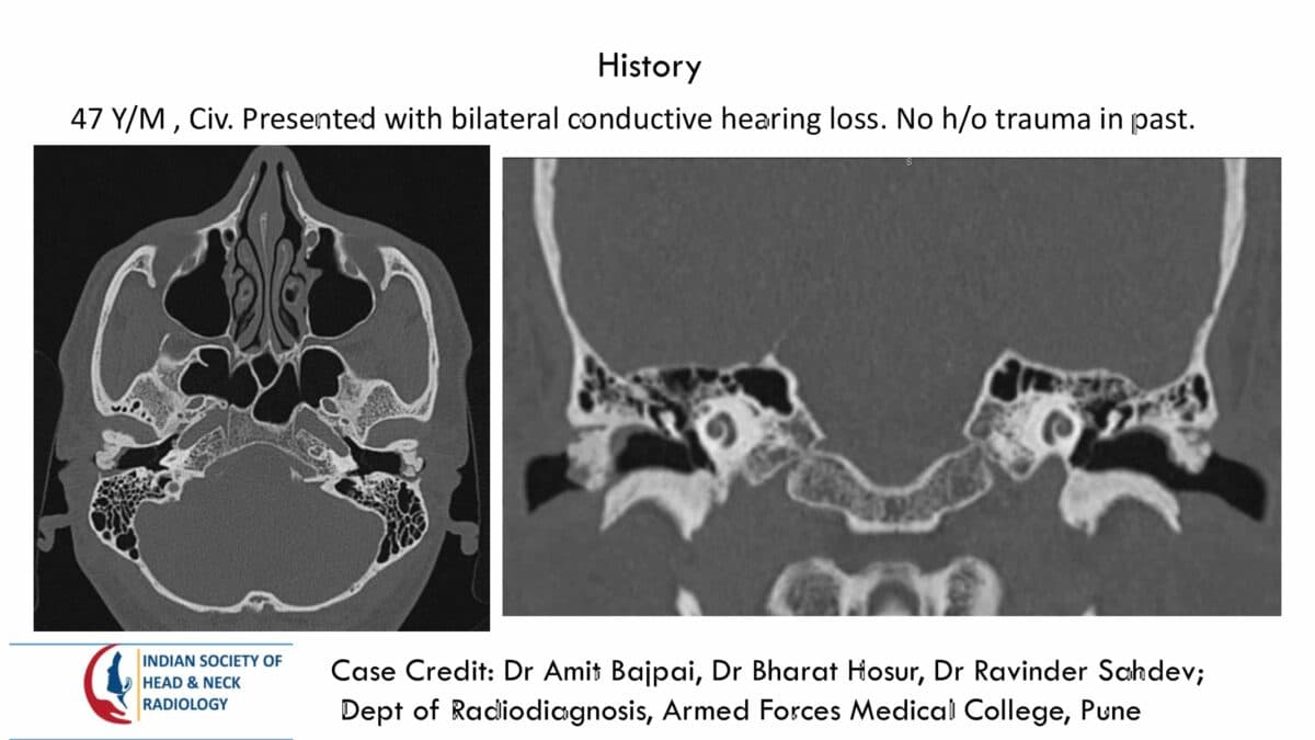 Case 72 — slide 1 of 3
