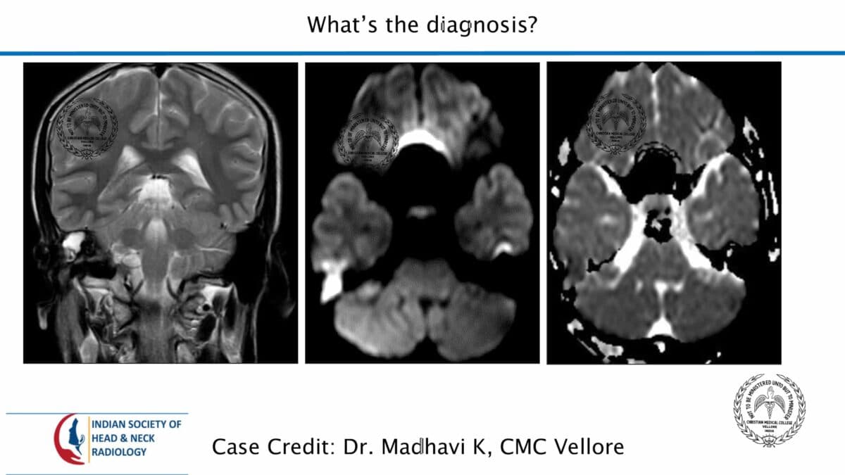 Case 73 — slide 1 of 2