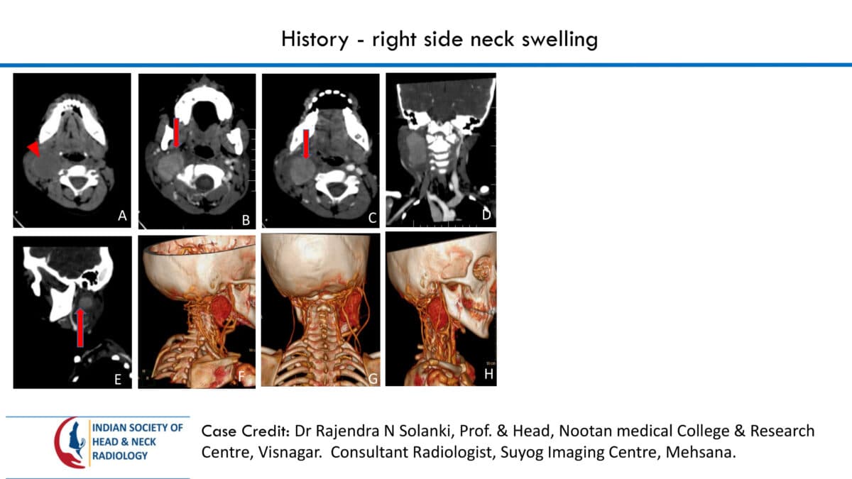 Case 76 — slide 1 of 5
