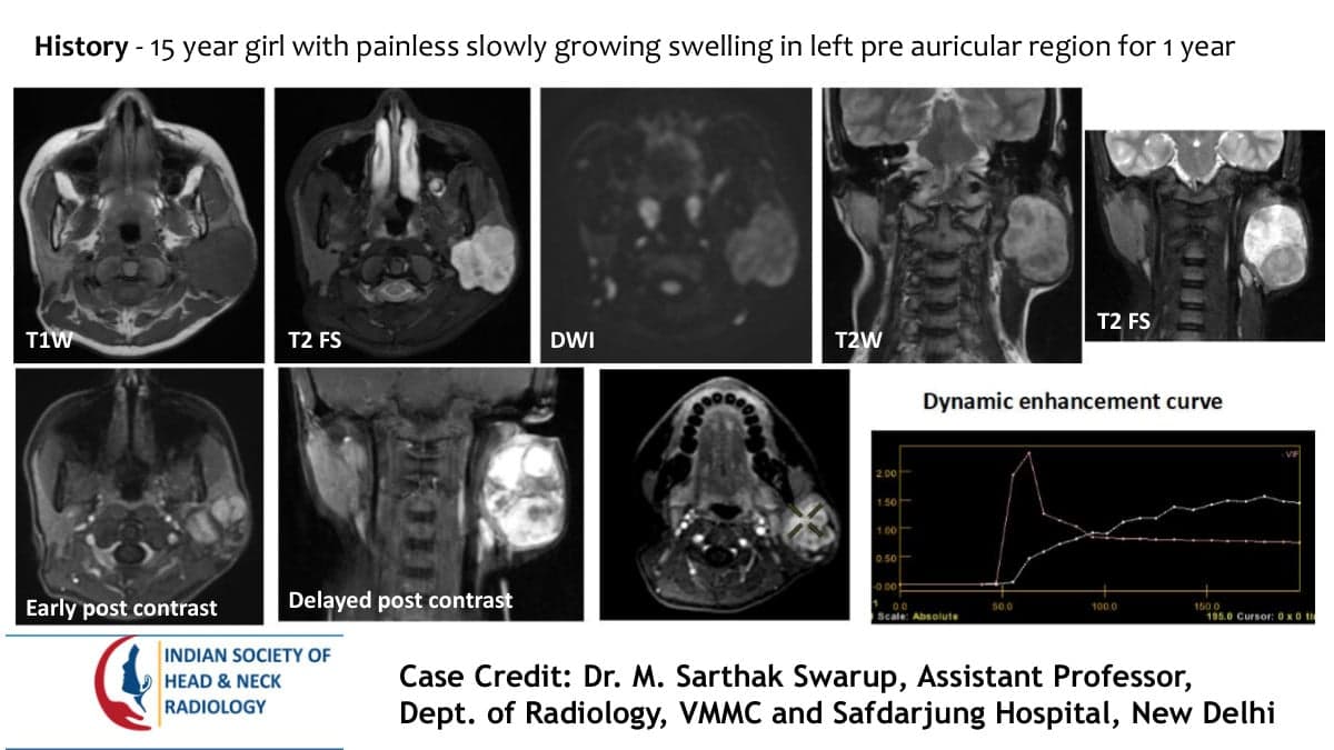 Case 78 — slide 1 of 4