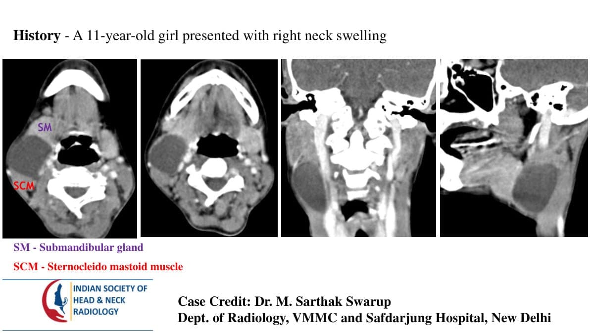 Case 80 — slide 1 of 4